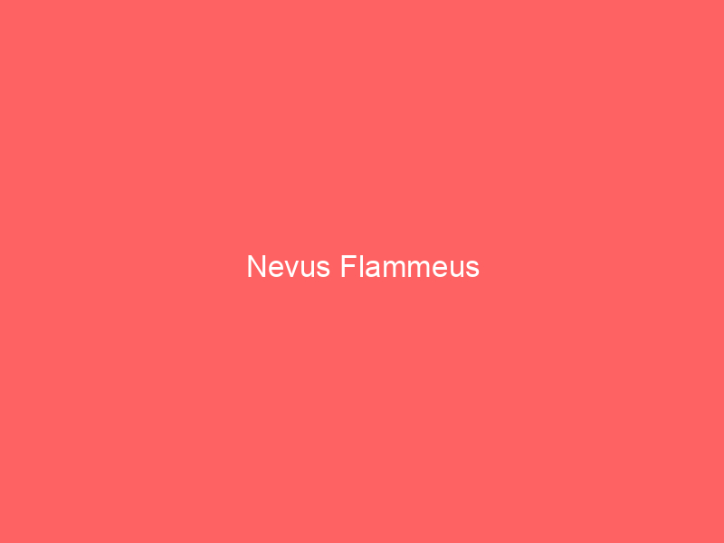 Nevus Flammeus