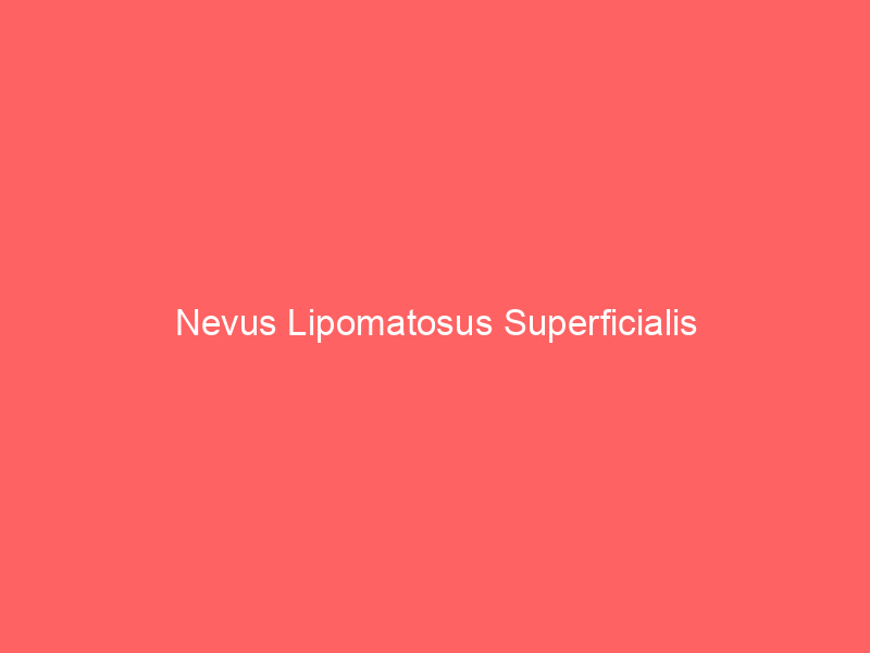 Nevus Lipomatosus Superficialis