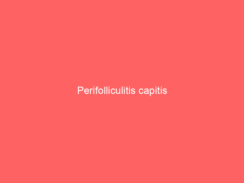 Perifolliculitis capitis