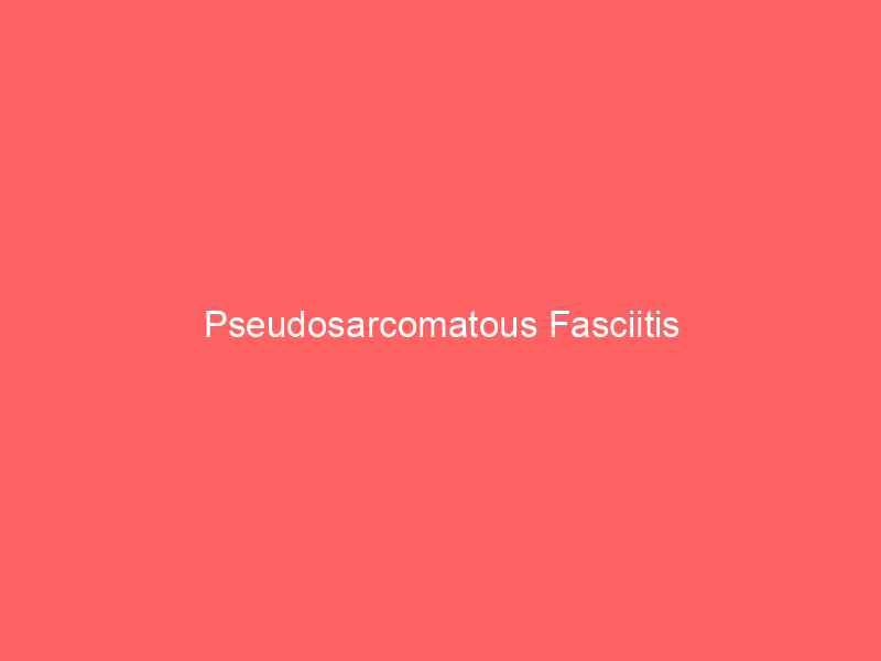 Pseudosarcomatous Fasciitis