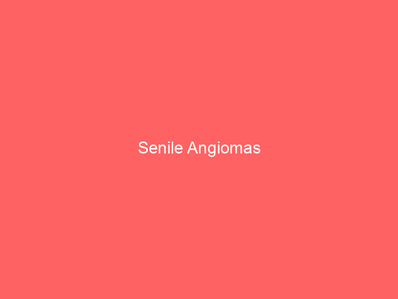 Senile Angiomas