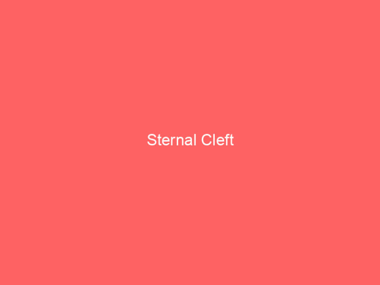 Sternal Cleft