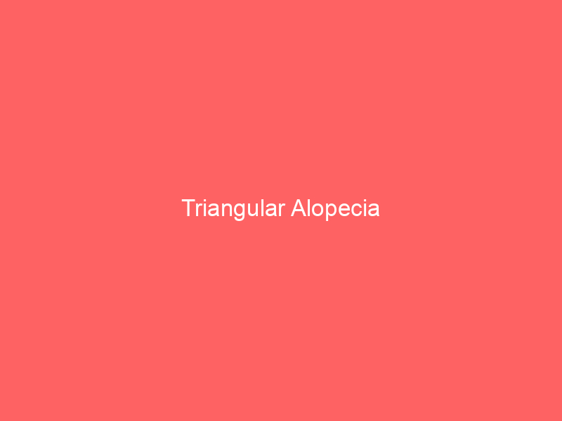 Triangular Alopecia