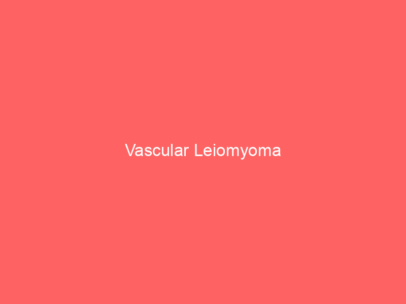 Vascular Leiomyoma