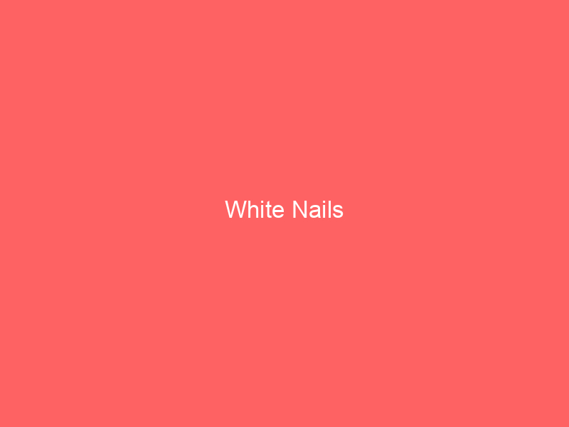White Nails