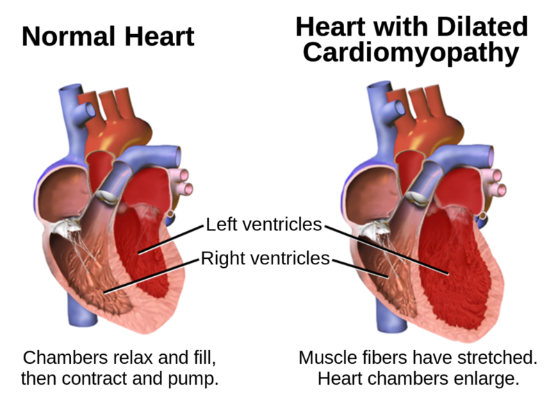 Cardiocutaneous Syndrome