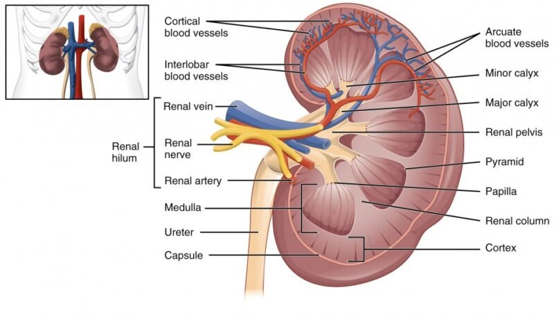 Calyceal Tumor