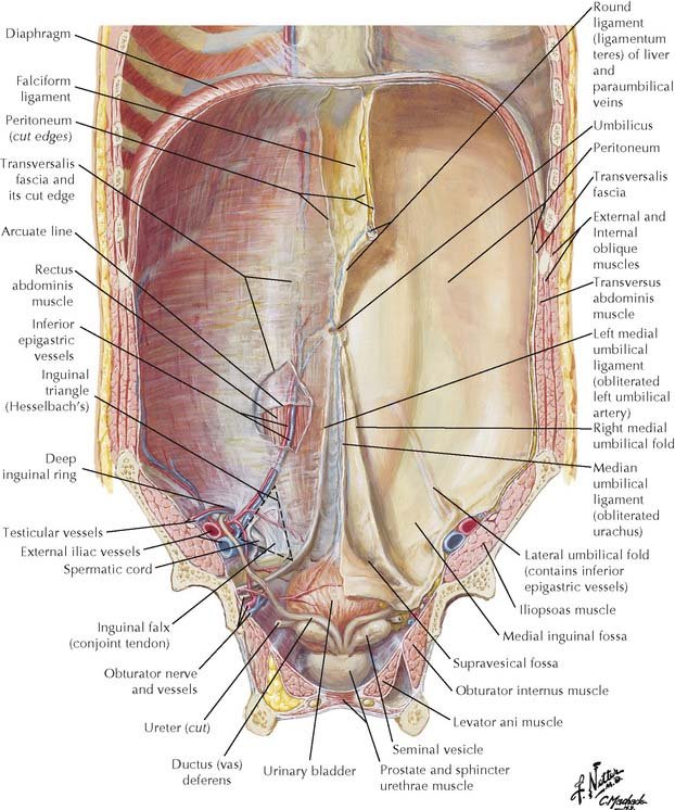 Inguinal Triangle Fibrosis