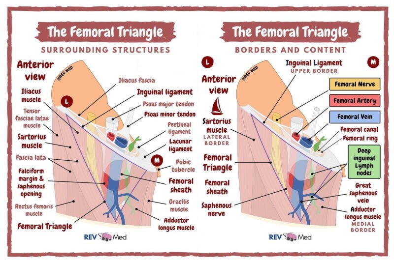 Inguinal Triangle Atrophy